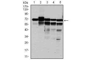Image no. 7 for anti-Replication Protein A1, 70kDa (RPA1) antibody (ABIN1500741) (RPA1 抗体)