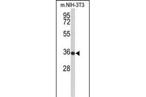 Western Blotting (WB) image for anti-Solute Carrier Family 25 (Mitochondrial Carrier, Peroxisomal Membrane Protein, 34kDa), Member 17 (SLC25A17) (AA 17-44), (N-Term) antibody (ABIN653119)