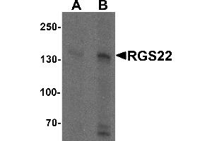 Western blot analysis of RGS22 in Jurkat cell lysate with RGS22 antibody at (A) 1 and (B) 2 µg/mL. (RGS22 抗体  (N-Term))