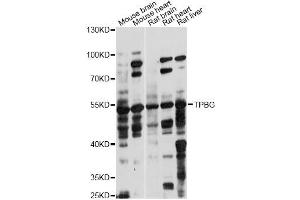 Western blot analysis of extracts of various cell lines, using TPBG antibody (ABIN6291221) at 1:1000 dilution. (TPBG 抗体)