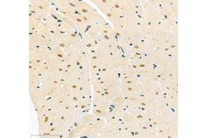 Immunohistochemistry (Paraffin-embedded Sections) (IHC (p)) image for anti-TEA Domain Family Member 3 (TEAD3) antibody (ABIN7075852)