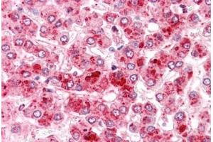 Human Liver: Formalin-Fixed, Paraffin-Embedded (FFPE) (COMT 抗体  (N-Term))