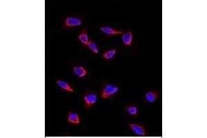 Immunofluorescence analysis of anti-SOX9 Antibody (N-term) in HeLa cells. (SOX9 抗体  (N-Term))
