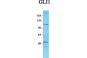 Host:  Rabbit  Target Name:  GLI1  Sample Tissue:  Human Jurkat  Antibody Dilution:  1. (GLI1 抗体  (C-Term))