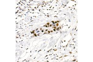 Immunohistochemistry of paraffin-embedded human placenta using DDX3X Rabbit pAb (ABIN6130252, ABIN6139494, ABIN6139495 and ABIN6221274) at dilution of 1:100 (40x lens). (DDX3X 抗体  (AA 1-220))