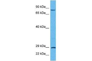 Host:  Rabbit  Target Name:  TRIM32  Sample Tissue:  Human HCT116 Whole Cell  Antibody Dilution:  1ug/ml (TRIM32 抗体  (C-Term))