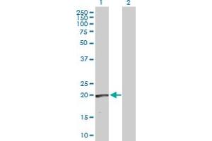 Western Blot analysis of RLN1 expression in transfected 293T cell line by RLN1 MaxPab polyclonal antibody.