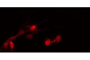 ABIN6267679 staining HeLa cells by IF/ICC. (HDAC2 抗体  (pSer394))