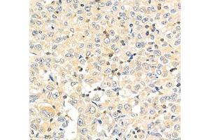 Immunohistochemistry (Paraffin-embedded Sections) (IHC (p)) image for anti-Protein Tyrosine Phosphatase G1 (PTPN12) antibody (ABIN7075292)
