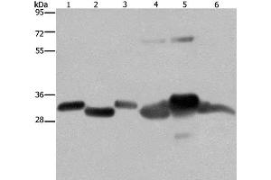 Western Blot analysis of Mouse thymus and Human ovarian cancer tissue, Mouse heart, Human fetal liver, Mouse liver tissue and SKOV3 cell using HMGCL Polyclonal Antibody at dilution of 1:300 (HMGCL 抗体)