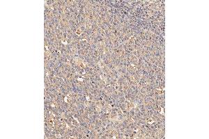 Immunohistochemical analysis of paraffin-embedded human appendix tissue using (ABIN1882197 and ABIN2843885) performed on the Leica® BOND RXm. (KIT 抗体)