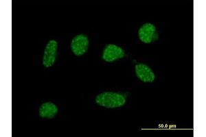 Immunofluorescence of  purified  MaxPab antibody to C19orf50 on HeLa cell. (C19orf50 抗体  (AA 1-176))