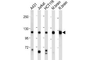 All lanes : Anti-PI3KCA Antibody (Center) at 1:2000 dilution Lane 1: A431 whole cell lysate Lane 2: Jurkat whole cell lysate Lane 3: HC whole cell lysate Lane 4: Mouse brain tissue lysate Lane 5: Rat brain tissue lysate Lysates/proteins at 20 μg per lane. (PIK3CA 抗体  (AA 504-533))