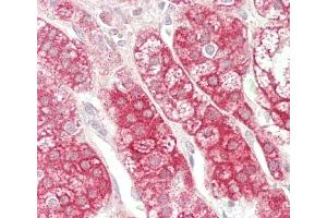 Immunohistochemistry (Paraffin-embedded Sections) (IHC (p)) image for anti-PTPRF Interacting Protein, Binding Protein 1 (Liprin beta 1) (PPFIBP1) (AA 588-617) antibody (ABIN1538519)