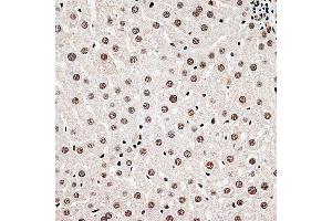 Immunohistochemistry of paraffin-embedded rat liver using CBX6 antibody (ABIN6127558, ABIN6138026, ABIN6138027 and ABIN6221185) at dilution of 1:100 (40x lens). (CBX6 抗体  (AA 80-180))