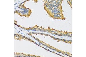 Immunohistochemistry of paraffin-embedded human prostate using CXCL11 antibody (ABIN6130151, ABIN6139269, ABIN6139270 and ABIN6221788) at dilution of 1:100 (40x lens). (CXCL11 抗体  (AA 22-94))