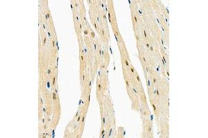 Immunohistochemistry of paraffin embedded mouse heart using COPS2 (ABIN7073324) at dilution of 1:1400 (400x lens) (CSN2 抗体)
