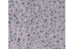 Used in DAB staining on fromalin fixed paraffin- embedded Kidney tissue (PTPRJ 抗体  (AA 1033-1277))