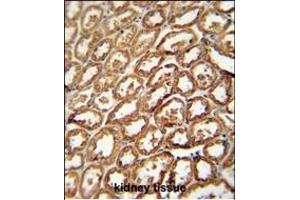 DEGS2 antibody (C-term) (ABIN654539 and ABIN2844256) immunohistochemistry analysis in formalin fixed and paraffin embedded human kidney tissue followed by peroxidase conjugation of the secondary antibody and DAB staining. (DEGS2 抗体  (C-Term))