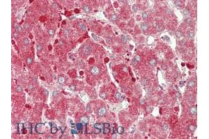 IHC-P analysis of Human Liver Tissue, with HE staining.