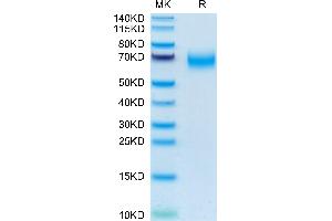 Human CD300A on Tris-Bis PAGE under reduced condition. (CD300a Protein (CD300A) (AA 18-180) (Fc Tag))