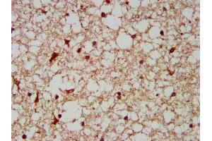 IHC image of ABIN7142166 diluted at 1:200 and staining in paraffin-embedded human brain tissue performed on a Leica BondTM system. (BCKDHA 抗体  (AA 268-407))