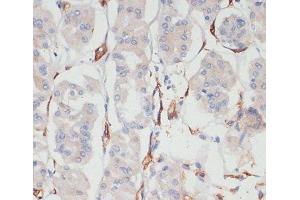 Immunohistochemistry of paraffin-embedded Human stomach using CD36 Polyclonal Antibody at dilution of 1:200 (40x lens). (CD36 抗体)