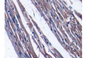 DAB staining on IHC-P; Samples: Rat Cardiac Muscle Tissue (TFAM 抗体  (AA 43-244))