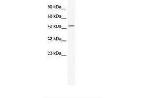 Image no. 1 for anti-DMRT-Like Family B with Proline-Rich C-terminal, 1 (DMRTB1) (AA 171-220) antibody (ABIN202289) (DMRTB1 抗体  (AA 171-220))