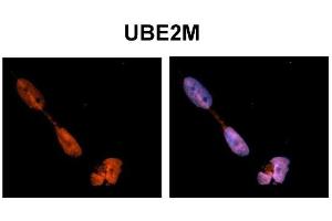Sample Type:    NT2 cells   Red:  Antibody   Blue:  DAPI   Primary Dilution:  1ug/50ul antibody   Secondary Antibody:  Alexa goat anti-rabbit 594   Image Submitted by:    Yuzhi Chen, University of Arkansas for Medical Sciences   (UBE2M 抗体  (N-Term))
