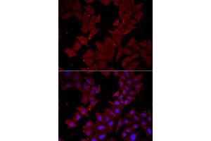 Immunofluorescence analysis of HeLa cell using CCT4 antibody. (CCT4 抗体)