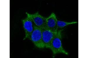 Confocal immunofluorescence image of LNCaP cells using AF488 labeled ODC-1 Mouse Monoclonal Antibody (ODC1/485) (Green). (ODC1 抗体)