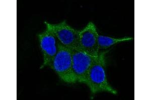 Confocal immunofluorescence image of LNCaP cells using AF488 labeled ODC-1 Mouse Monoclonal Antibody (ODC1/485) (Green).