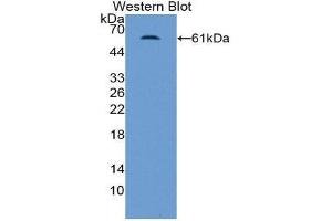 Western Blotting (WB) image for anti-Nuclear Receptor Subfamily 3, Group C, Member 2 (NR3C2) (AA 739-984) antibody (ABIN1859878) (NR3C2 抗体  (AA 739-984))