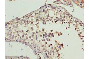 Immunohistochemistry of paraffin-embedded human testis tissue using ABIN7160978 at dilution of 1:100 (CYB5R2 抗体  (AA 1-237))