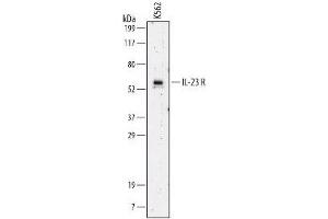 Image no. 1 for anti-Interleukin 23 Receptor (IL23R) (AA 24-354) antibody (ABIN204348) (IL23R 抗体  (AA 24-354))