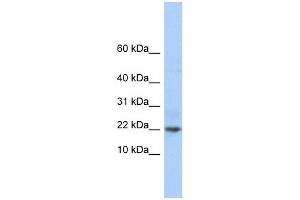 C9ORF25 antibody used at 1 ug/ml to detect target protein. (C9orf25 抗体  (Middle Region))