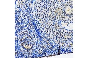Immunohistochemistry of paraffin-embedded rat ovary using TP53 antibody. (p53 抗体  (AA 1-100))