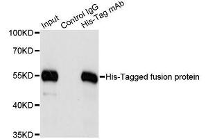 Immunoprecipitation of over-expressed His-tagged protein in 293T cells incubated using His-tag antibody.