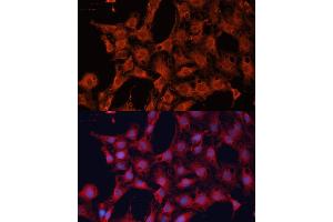 Immunofluorescence analysis of C6 cells using DN antibody (ABIN6127811, ABIN6139695, ABIN6139696 and ABIN6222849) at dilution of 1:100.