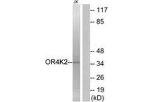 Western blot analysis of extracts from Jurkat cells, using OR4K2 Antibody. (OR4K2 抗体  (AA 265-314))