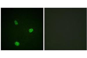 Immunofluorescence analysis of HeLa cells, using MITF (epitope around residue 180/73) antibody. (MITF 抗体  (Ser73, Ser180))