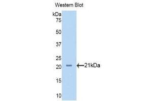 Western Blotting (WB) image for anti-Neuropilin 1 (NRP1) (AA 646-814) antibody (ABIN1173419) (Neuropilin 1 抗体  (AA 646-814))