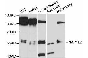 Western blot analysis of extracts of various cell lines, using NAP1L2 antibody (ABIN5998302) at 1:3000 dilution. (NAP1L2 抗体)