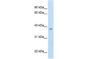 Western Blot showing ZMYND11 antibody used at a concentration of 1-2 ug/ml to detect its target protein. (ZMYND11 抗体  (Middle Region))