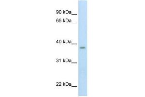 Western Blotting (WB) image for anti-Zinc Finger, MYND-Type Containing 11 (ZMYND11) (Middle Region) antibody (ABIN925794)