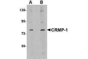 Western blot analysis of CRMP1 in rat brain tissue lysate with AP30244PU-N CRMP1 antibody at (A) 1 and (B) 2 μg/ml. (CRMP1 抗体  (N-Term))