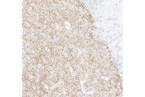 Immunohistochemistry (IHC) image for anti-Tyrosine Hydroxylase (TH) (AA 450-500) antibody (ABIN7449433)