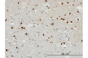 Image no. 1 for anti-Fibroblast Growth Factor 12 (FGF12) (AA 1-182) antibody (ABIN598680) (FGF12 抗体  (AA 1-182))