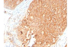 Formalin-fixed, paraffin-embedded human Pancreas stained with Topo I Rabbit Recombinant Monoclonal Antibody (TOP1MT/2883R). (Recombinant TOP1MT 抗体)